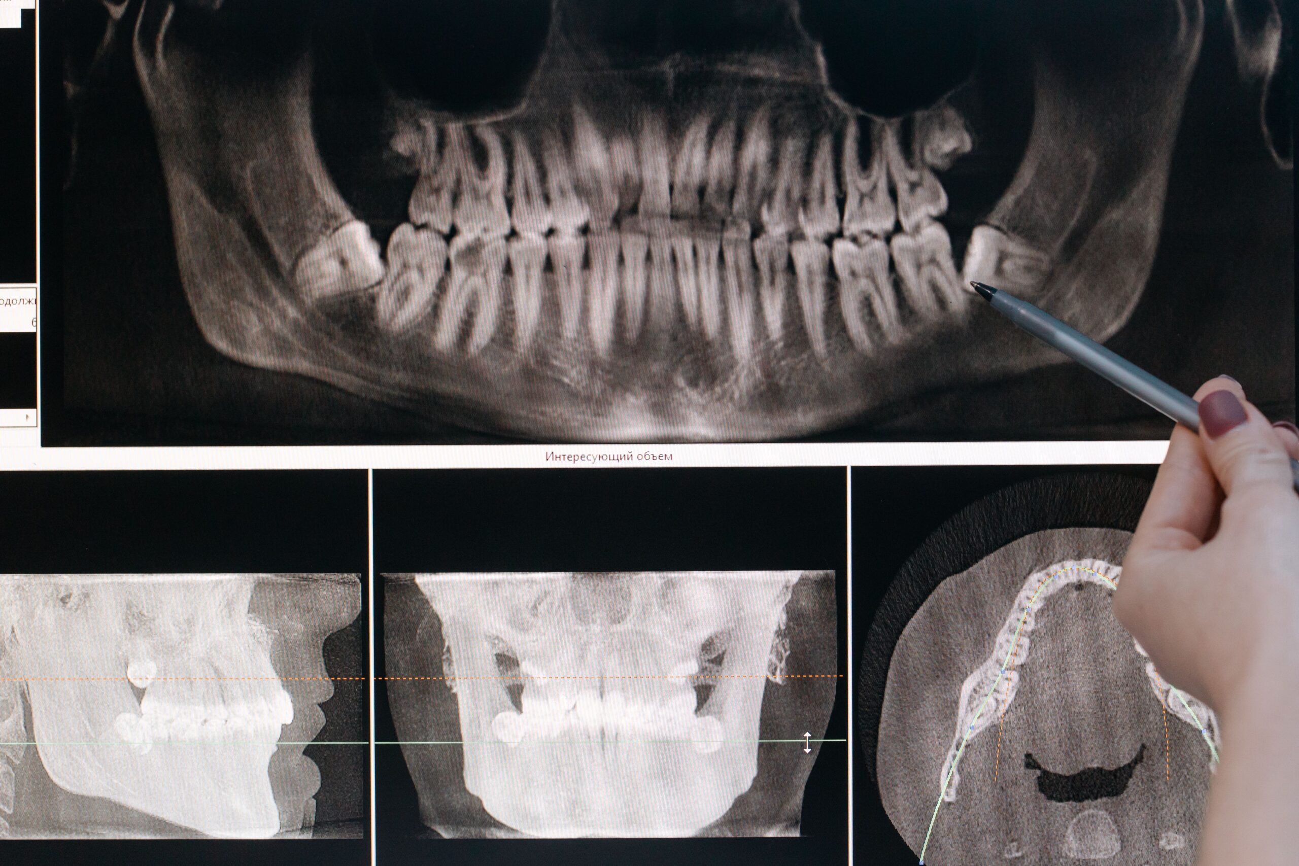 Dentist performing an oral soft-tissue examination before a biopsy in Sri Petaling