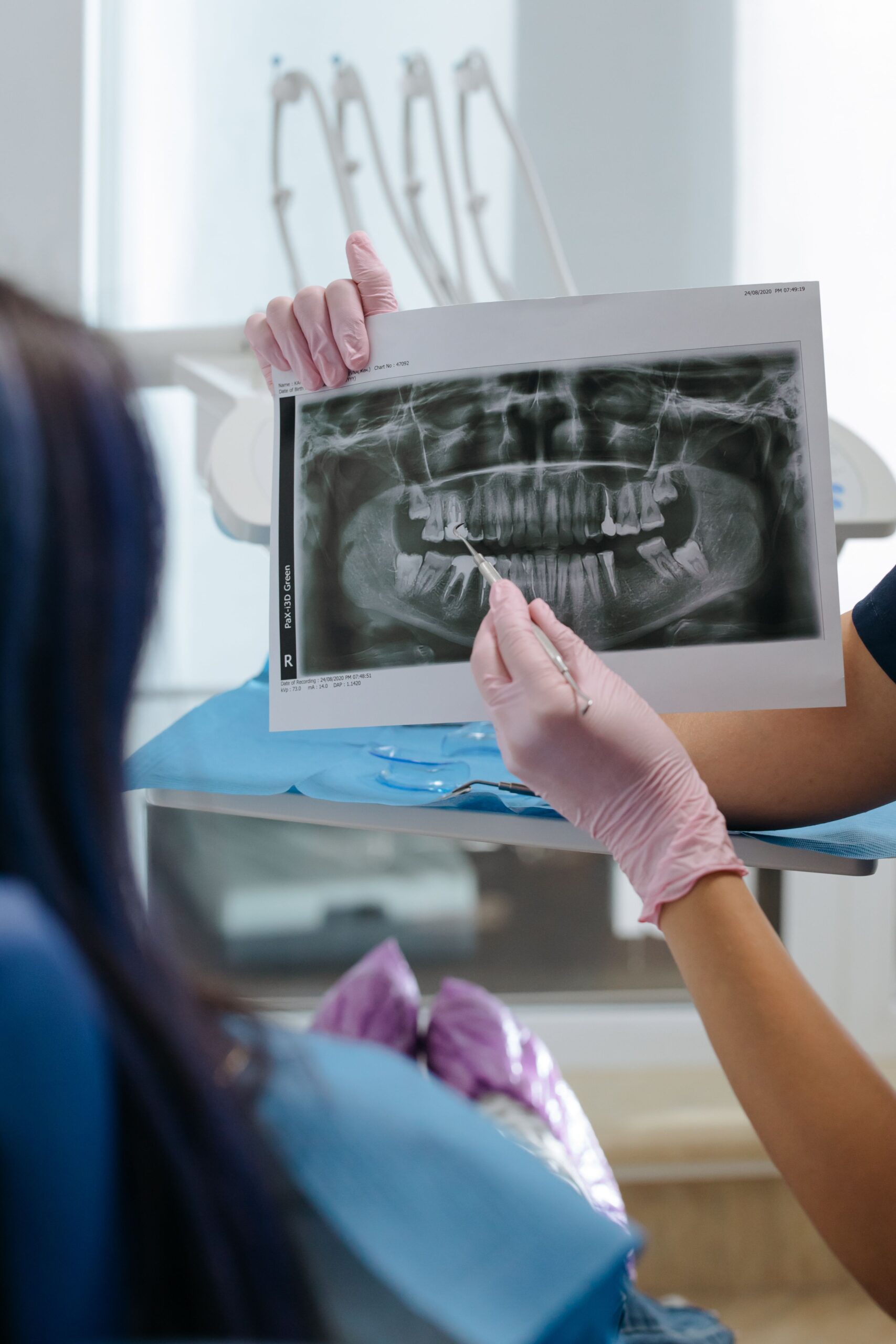 Dentist reviewing a dental X-ray showing a jaw cyst with a patient at LeSmile Dental Clinic Sri Petaling